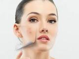 Beauty Tips & Best Beauty Treatments